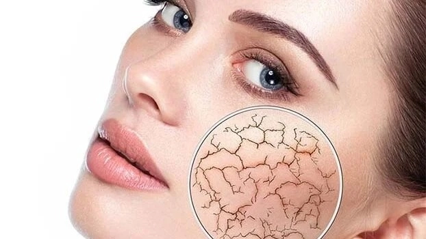 فاكهة "سحرية" لعلاج جفاف البشرة في الشتاء 