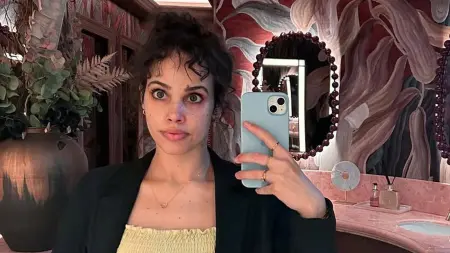 related_news_inside_blogsمرض نور عمرو دياب.. ابنة الهضبة تكشف تفاصيل أزمتها الصحية