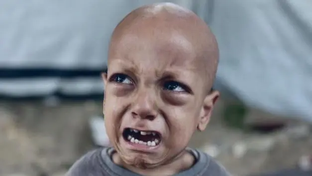 وفاة الطفل عبد الله أبو زرقة الغزاوي صاحب عبارة "أنا جعان"