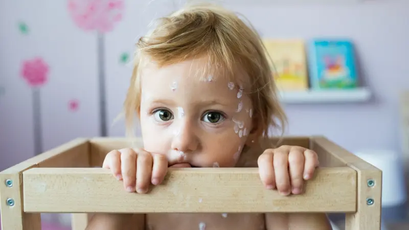 يبلغ ذروته أوائل الربيع والصيف.. ما هو جدري الماء عند الأطفال؟