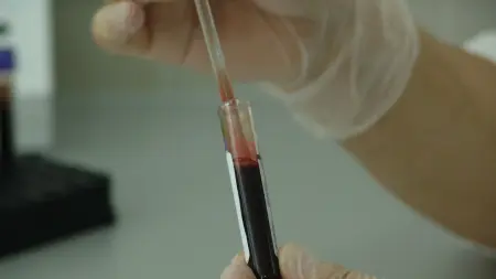 الصحة الألمانية تدعو الشباب إلى التبرع بالدم.. ما السبب؟