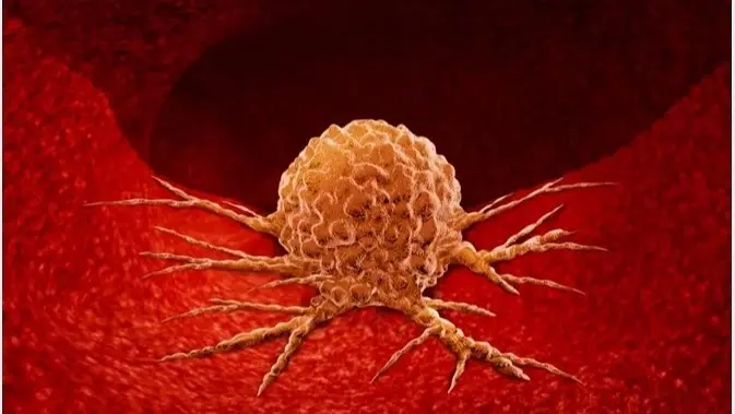 الورم مخادع.. ما سبب فشل أقوى علاجات السرطان؟
