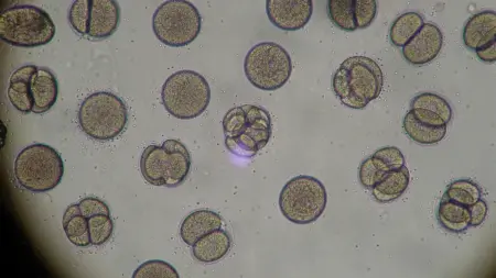 "بوند الشرير".. اكتشاف جديد قد يُحدث ثورة في علاج السرطان