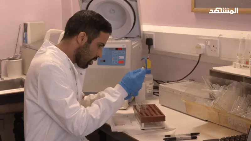 دراسات: انتشار القولون العصبي بين البالغين في الأردن