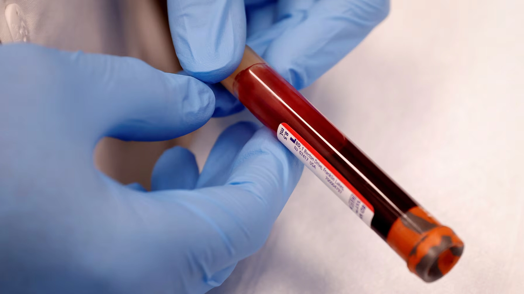 تقرير: تحليل دم متطور يتنبأ بالأمراض قبل ظهورها بعقد كامل 