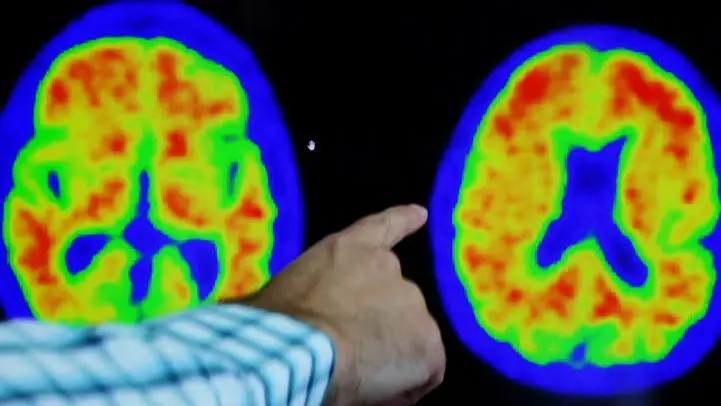 النتائج تمهد لأهداف علاجية جديدة للحفاظ على وظيفة الأوعية الدموية (رويترز) النتائج تمهد لأهداف علاجية جديدة للحفاظ على وظيفة الأوعية الدموية (رويترز)