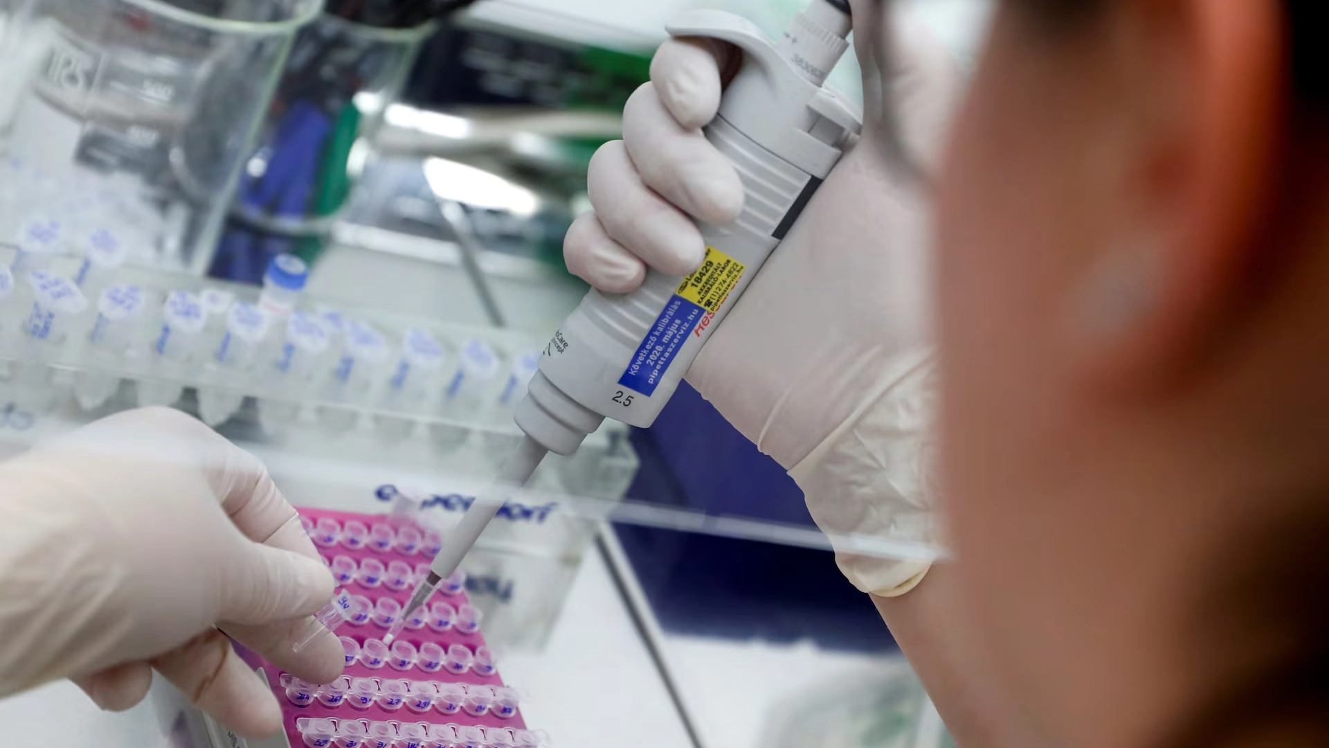 أبحاث حديثة تكشف فعالية علاج تجريبي ضد سرطان الدم 