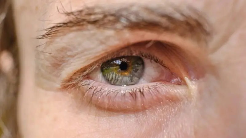 إليك طرق التخلص من رفّة الجفن المزعجة