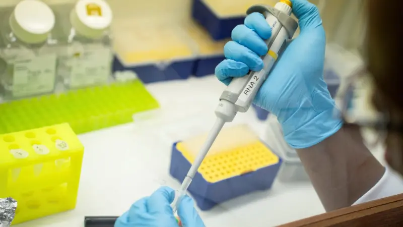 تطور في تعديل الجينات قد يؤدي إلى علاج لمتلازمة داون