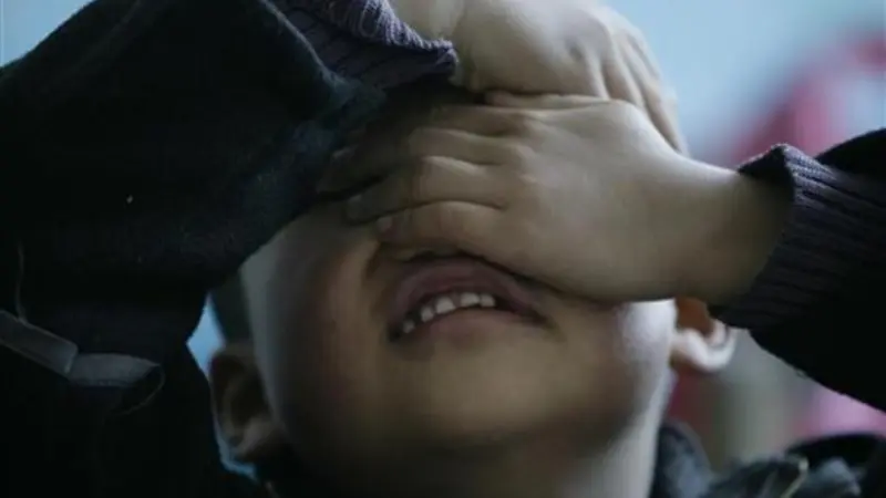 اكتشاف أنواع فرعية من التوحد.. والعلاج بحسب الحالة