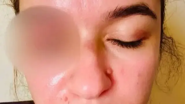 زوجة فنان مصري تتهمه بضربها وسحلها