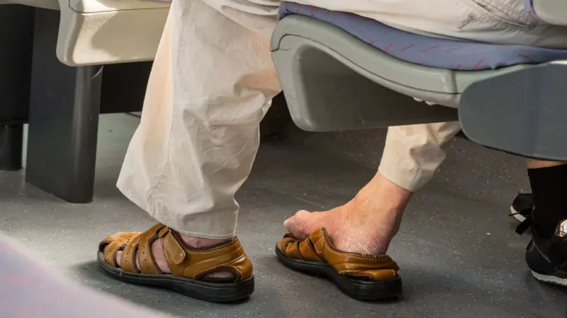 إليكم علاج تشققات القدمين في يوم واحد فقط مجرب وفعال