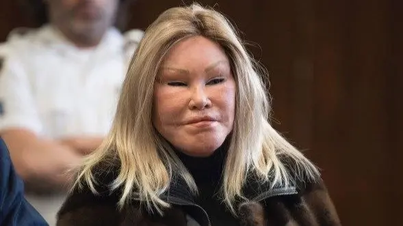 فيديو - "المرأة القطة".. من هي جوسلين ويلدنشتاين وما سبب وفاتها؟