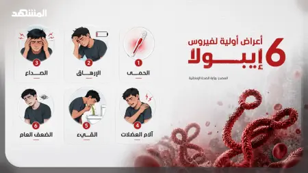 related_news_inside_blogsمنظمة الصحة: 321 إصابة مؤكدة بإيبولا في الكونغو