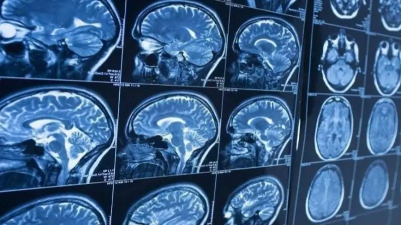 دراسة: تلف القلب قد يكون مرتبطا بالخرف