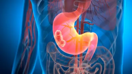 related_news_inside_blogsالمرض الفتاك.. التوصل لأدوية جديدة لعلاج سرطان البنكرياس