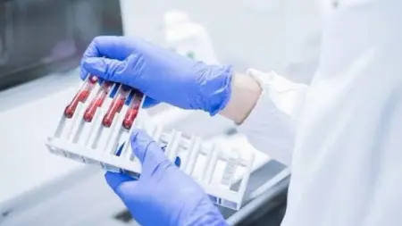 related_news_inside_blogsدراسة تكشف مفاجأة: فيروس شائع يؤثر على مسار سرطان نادر بالدماغ
