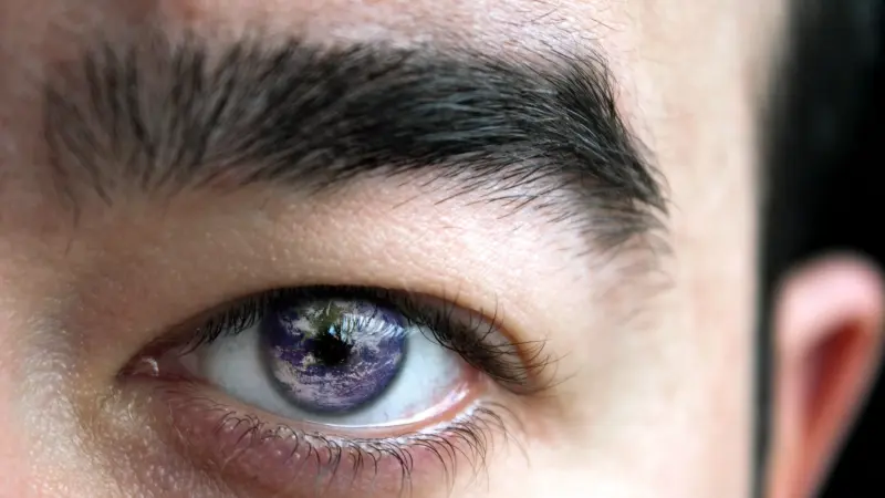 هل يُسبب التوتر العمى؟ العلم يحسم الجدل