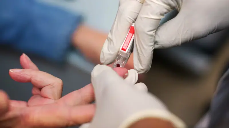 علماء يطورون تحليل دم يقدّر بدقة تطور أمراض الكلى