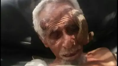 صور - بعد بتر "قرنيه".. وفاة المعمّر اليمني علي عنتر عن 140 عاما