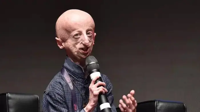 من هو سامي باسو وسبب وفاته؟ 10 معلومات عن الأطول عمرا بين مصابي الشيخوخة المبكرة