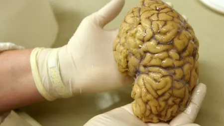 related_news_inside_blogsدراسة: عادات يومية قد تحمي من أخطر الأمراض العصبية