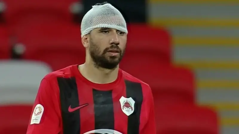 قبل انضمامه للأهلي.. تريزيجيه يتعرض لإصابة دامية