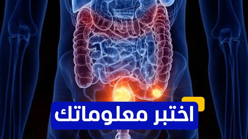 اختبر معلوماتك - ما هو الفحص الطبي الذي يُستخدم للكشف المبكر عن سرطان القولون؟