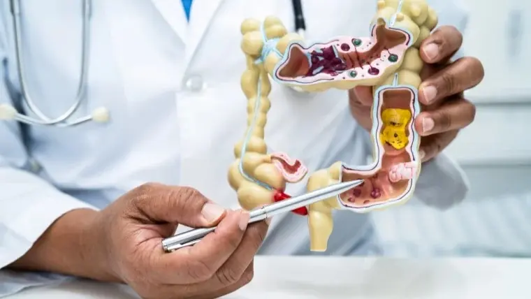 دراسات مُقلقة.. تعرّف إلى مُسبّبات سرطان القولون لدى الشباب