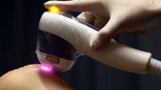 انتشار ظاهرة إزالة شعر الجسم بين الرجال في اليابان (رويترز) انتشار ظاهرة إزالة شعر الجسم بين الرجال في اليابان (رويترز)