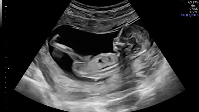 دراسة جديدة.. هل سيتم وضع حدّ للأمراض الوراثية؟