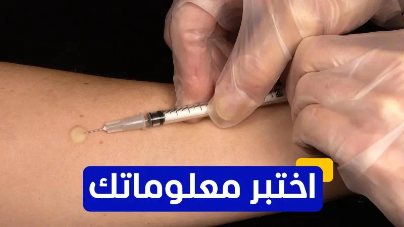 اختبر معلوماتك عن تاريخ مرض السل