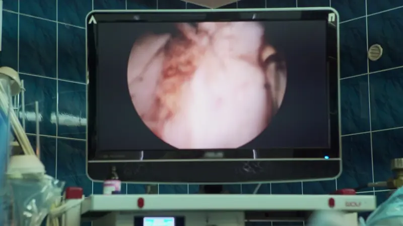 الكشف عن السبب الرئيسي لسرطان الجلد