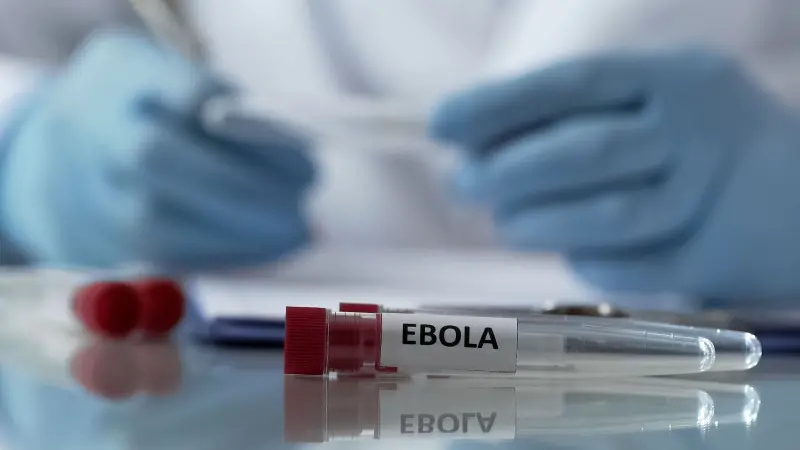 بدء تجارب سريرية على علاجين محتملين لفيروس إيبولا