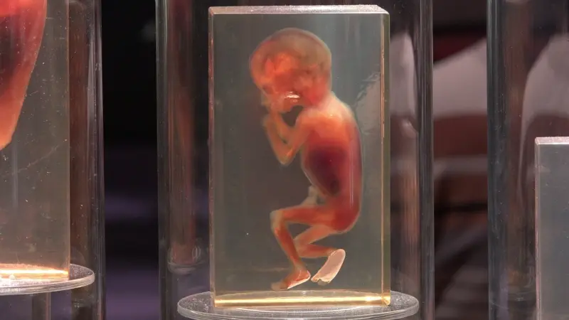 ليس بالأدوية.. طرق تقليدية للإجهاض المنزلي في أفغانستان