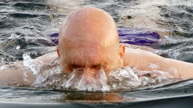 دواء الصلع.. علاج شائع قد يكافح أمراض القلب