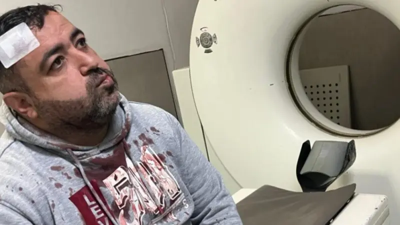 تفاصيل الاعتداء على الصحفي فيصل التميمي بالأردن.. هذا ما كشفته التحقيقات