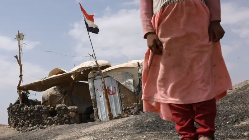 فيديو - استمرار تفشي الكوليرا بسبب تلوث المياه وتدهور القطاع الصحي في اليمن