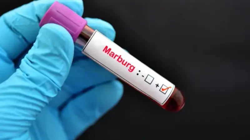 فيروس ماربورغ القاتل.. هل ينتقل من إثيوبيا لمصر؟