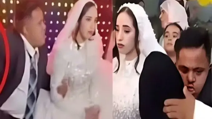 معلومات مفاجئة في واقعة زواج عريس متلازمة داون في مصر