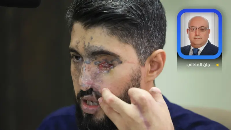 سنة أولى على "بيجر"