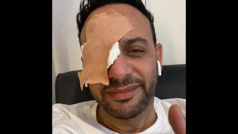 صور - مصطفى قمر يتوعّد بالردّ على خالد سرحان بعدما ضربه على عينه