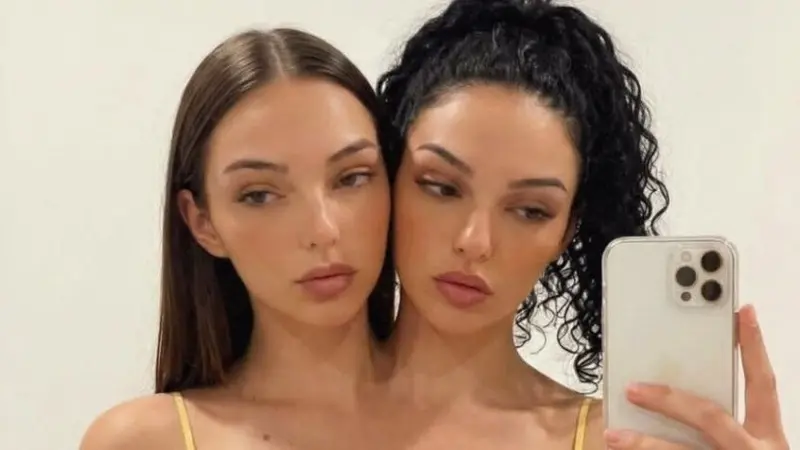حقيقة التوأم الملتصق فاليريا وكاميلا بعد تصدرهما الترند