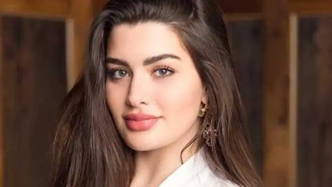 "الذئبة".. روان بن حسين تكشف سبب نحافتها الشديدة