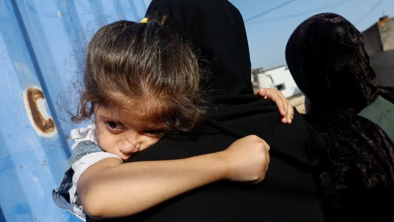 54,600 طفل في غزة يعانون من سوء تغذية حاد