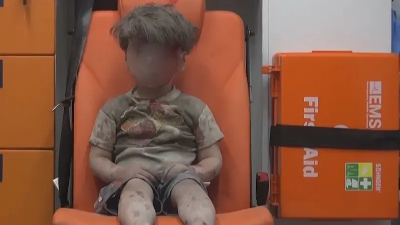 9 أعوام على صورته.. الطفل السوري الذي أبكى العالم يروي حكايته