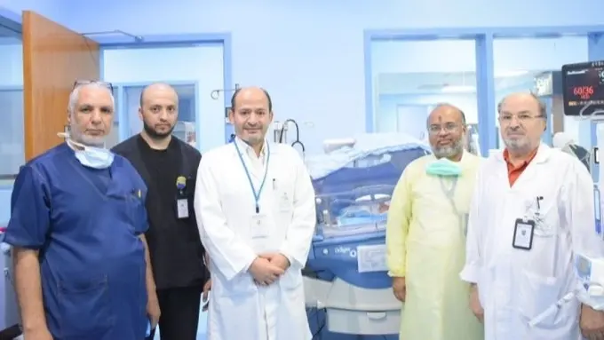 حالة نادرة.. ولادة توأم بمتلازمة داون في السعودية