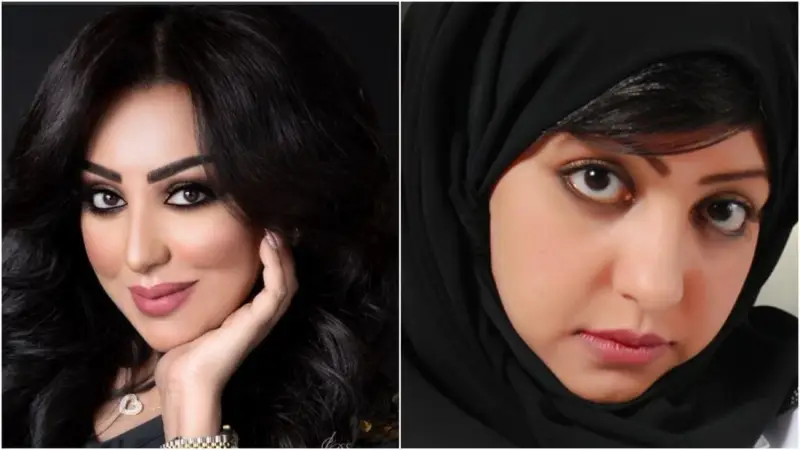 ريماس منصور قبل وبعد التجميل ريماس منصور قبل وبعد التجميل