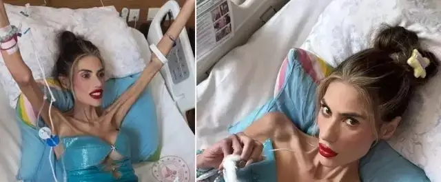 جاء سبب وفاة عارضة الأزياء التركية نيهال صادم للكثيرين