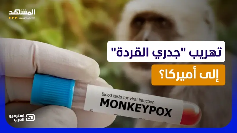 news_suggested_videos_تهريب فيروس جدري القردة إلى الولايات المتحدة.. وصدمة في غرفة التحقيق! 